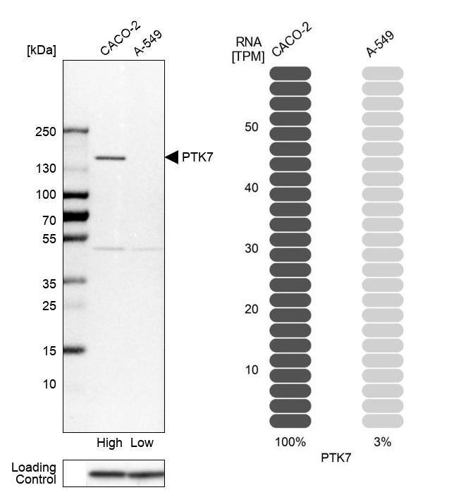 PTK7/CCK4 Antibody - BSA Free Western Blot: PTK7/CCK4 Antibody - BSA Free [NBP1-88157]