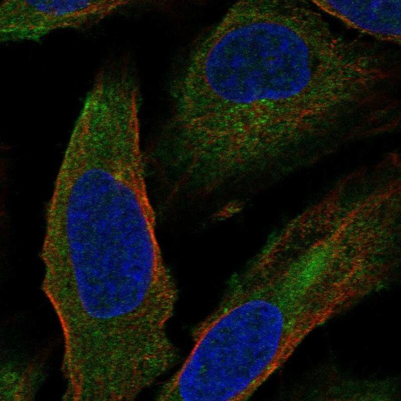 CCDC5 Antibody - BSA Free Immunocytochemistry/ Immunofluorescence: CCDC5 Antibody [NBP1-88159]
