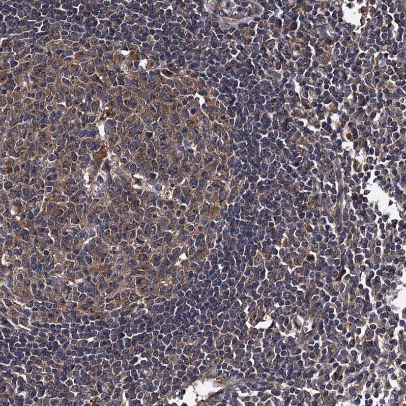 CCDC5 Antibody - BSA Free Immunohistochemistry-Paraffin: CCDC5 Antibody - BSA Free [NBP1-88159]