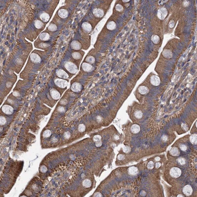 CCDC5 Antibody - BSA Free Immunohistochemistry-Paraffin: CCDC5 Antibody - BSA Free [NBP1-88159]