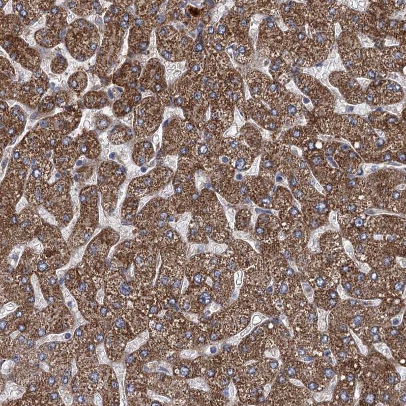CCDC5 Antibody - BSA Free Immunohistochemistry-Paraffin: CCDC5 Antibody - BSA Free [NBP1-88159]