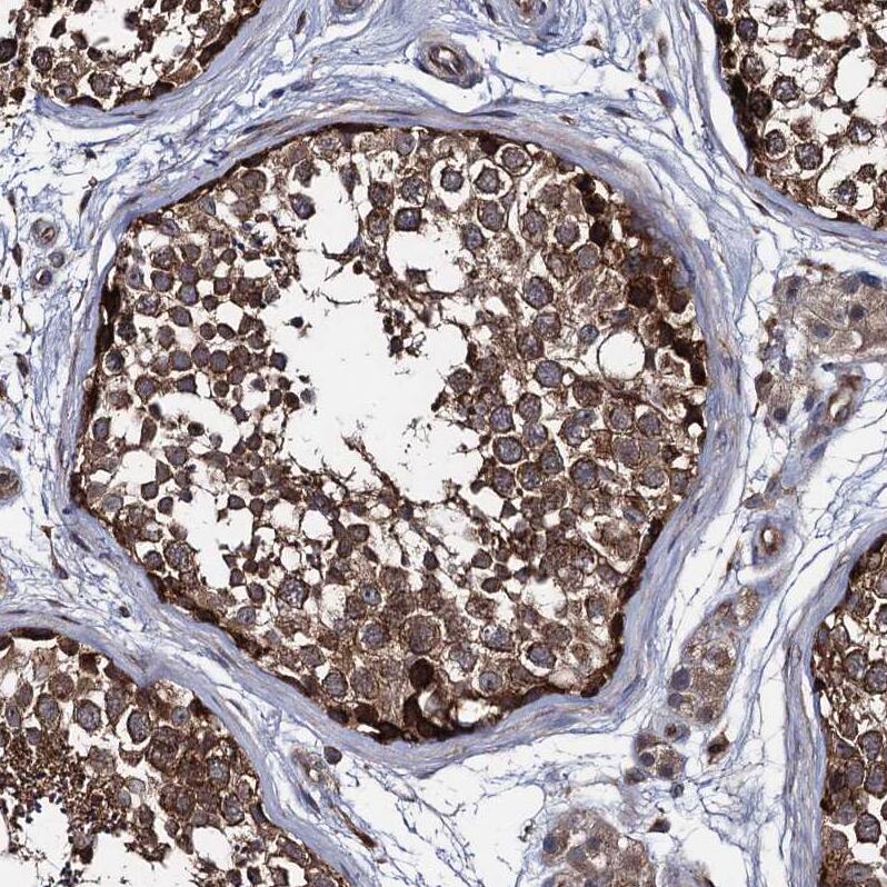 CCDC5 Antibody - BSA Free Immunohistochemistry-Paraffin: CCDC5 Antibody - BSA Free [NBP1-88159]