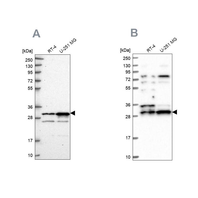 CCDC5 Antibody - BSA Free Western Blot: CCDC5 Antibody - BSA Free [NBP1-88159]