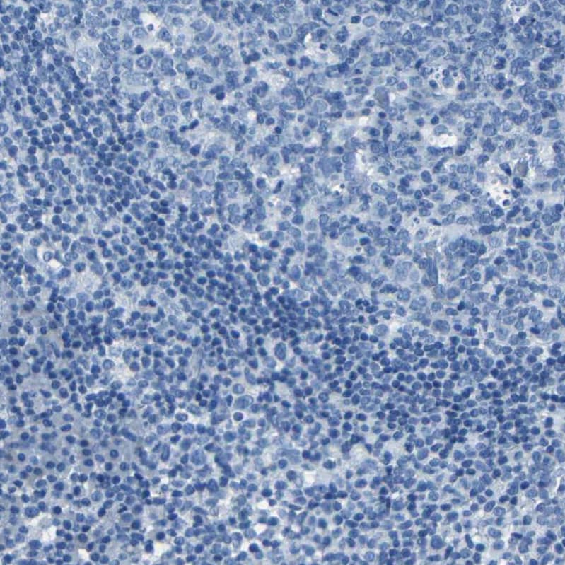 Fibrillin 2 Antibody - BSA Free Immunohistochemistry-Paraffin: Fibrillin 2 Antibody - BSA Free [NBP1-88169]