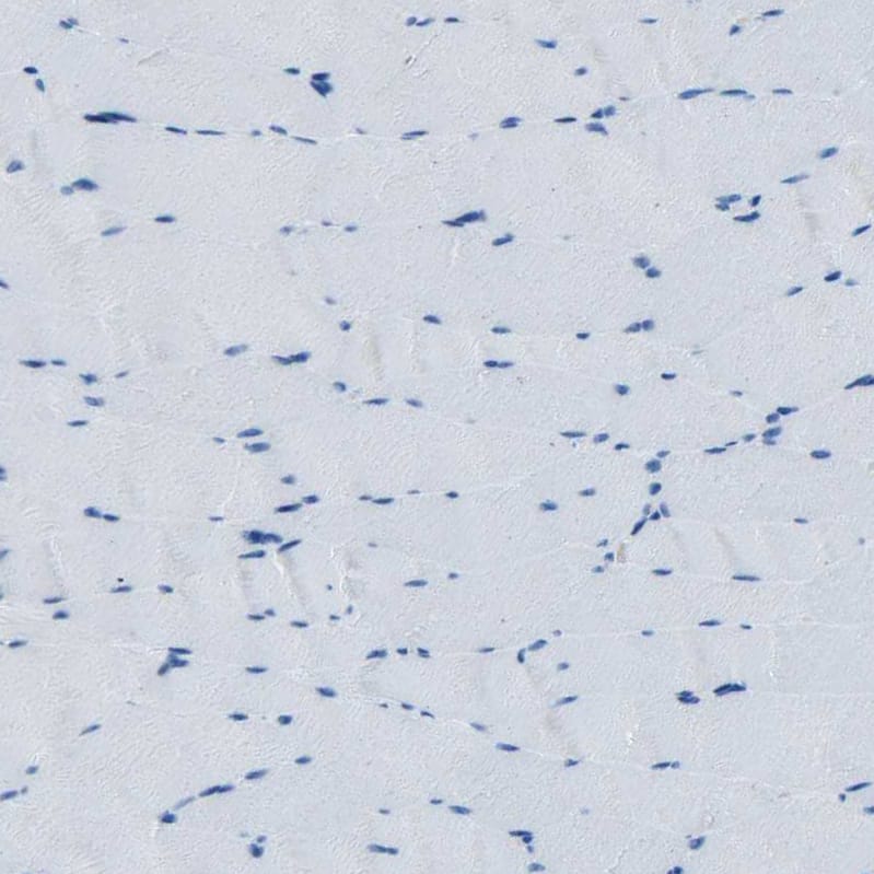 Fibrillin 2 Antibody - BSA Free Immunohistochemistry-Paraffin: Fibrillin 2 Antibody - BSA Free [NBP1-88169]