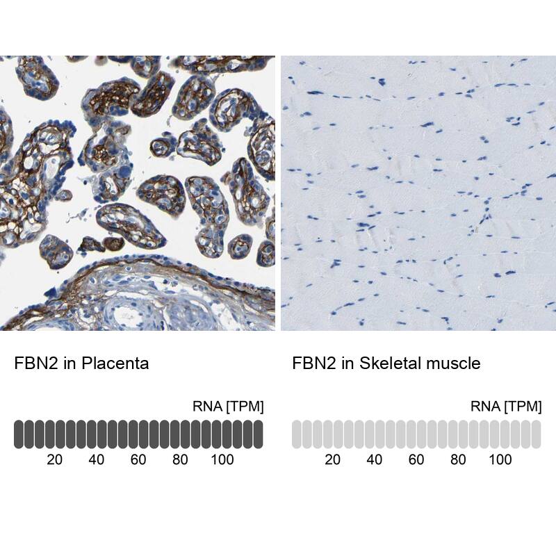 Fibrillin 2 Antibody - BSA Free Immunohistochemistry-Paraffin: Fibrillin 2 Antibody - BSA Free [NBP1-88169]