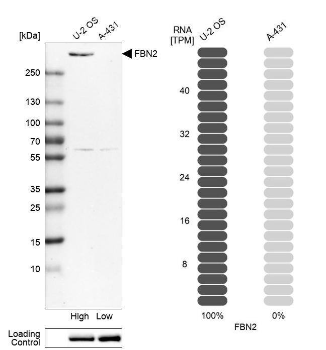 Fibrillin 2 Antibody - BSA Free Western Blot: Fibrillin 2 Antibody - BSA Free [NBP1-88169]
