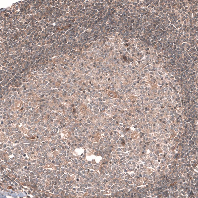 Cav3.2 Antibody - BSA Free Immunohistochemistry-Paraffin: Cav3.2 Antibody [NBP1-88176]