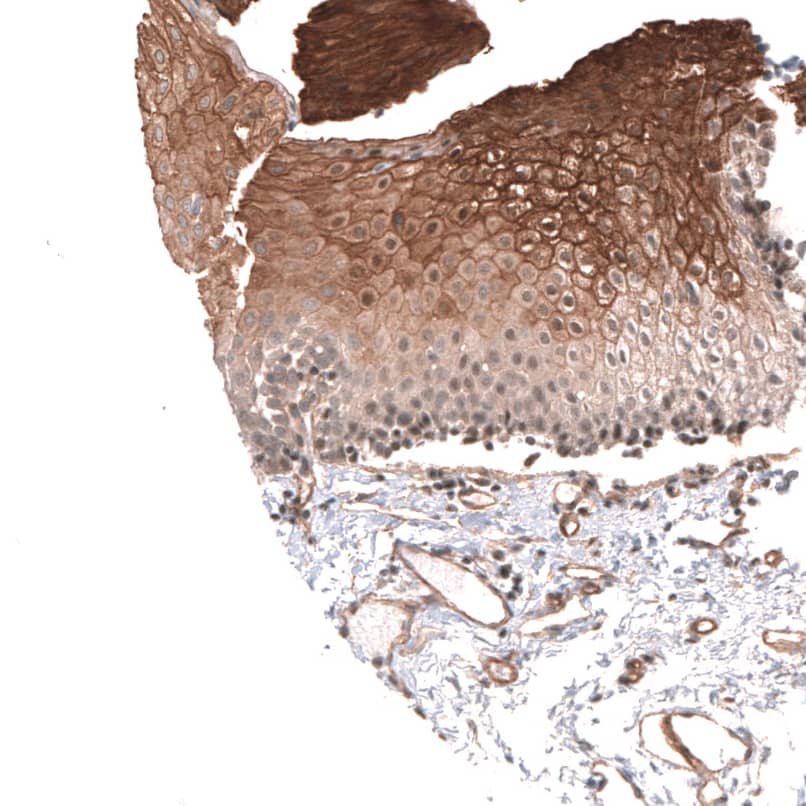 Cav3.2 Antibody - BSA Free Immunohistochemistry-Paraffin: Cav3.2 Antibody [NBP1-88176]