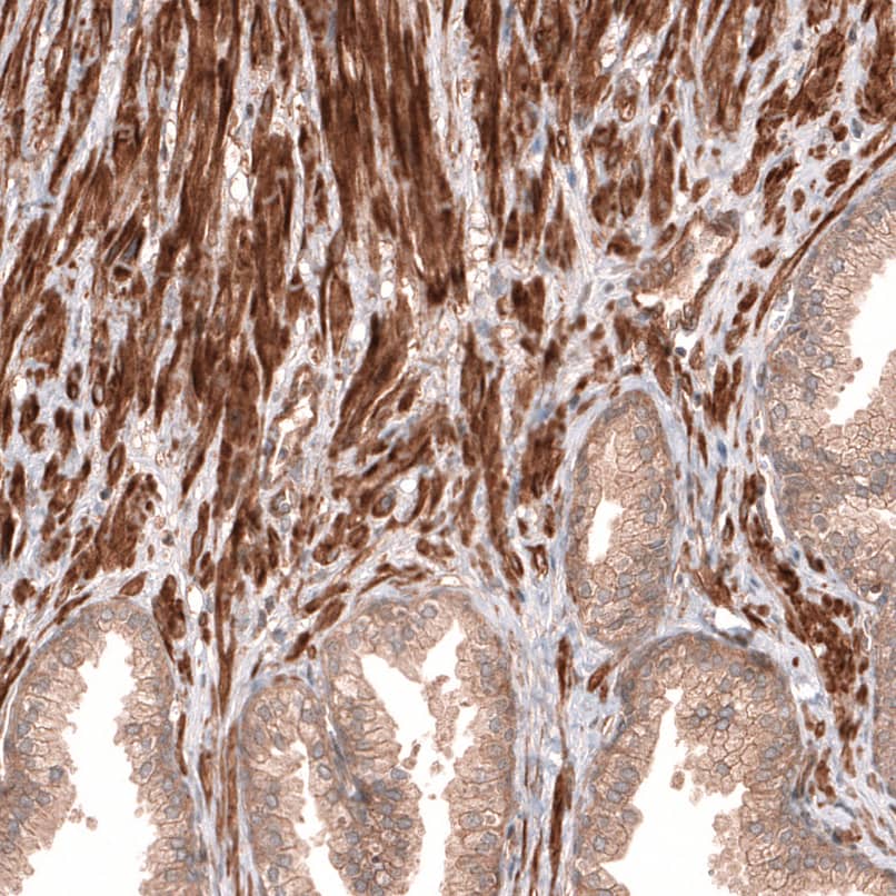 Cav3.2 Antibody - BSA Free Immunohistochemistry-Paraffin: Cav3.2 Antibody [NBP1-88176]