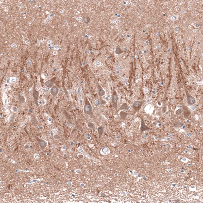 Cav3.2 Antibody - BSA Free Immunohistochemistry-Paraffin: Cav3.2 Antibody [NBP1-88176]
