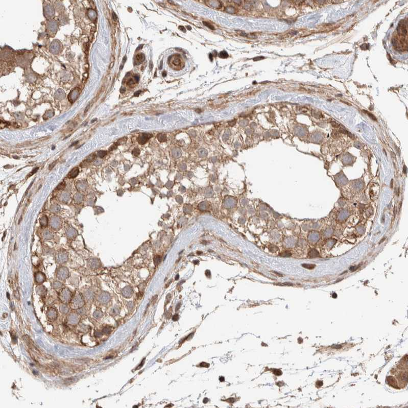 ELKS Antibody - BSA Free Immunohistochemistry-Paraffin: ELKS Antibody - BSA Free [NBP1-88177]