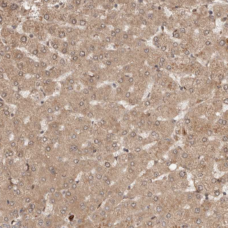 ELKS Antibody - BSA Free Immunohistochemistry-Paraffin: ELKS Antibody - BSA Free [NBP1-88177]