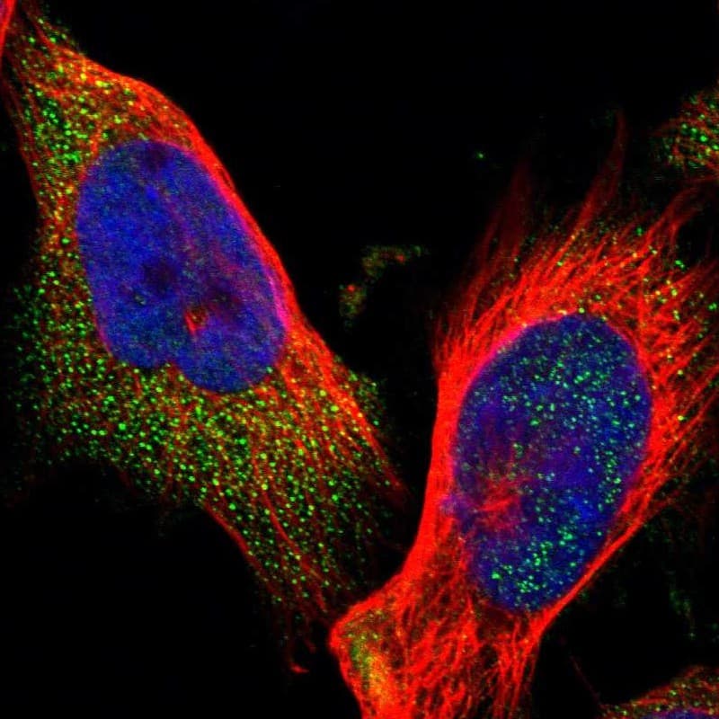 ELKS Antibody - BSA Free Immunocytochemistry/ Immunofluorescence: ELKS Antibody - BSA Free [NBP1-88177]
