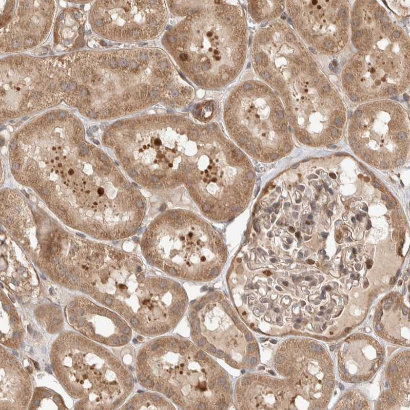 ELKS Antibody - BSA Free Immunohistochemistry-Paraffin: ELKS Antibody - BSA Free [NBP1-88177]