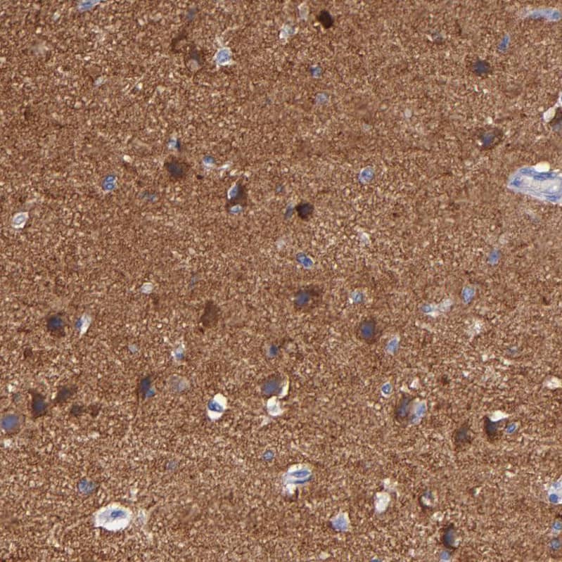 Caspr2 Antibody - BSA Free Immunohistochemistry-Paraffin: Caspr2 Antibody - BSA Free [NBP1-88182]