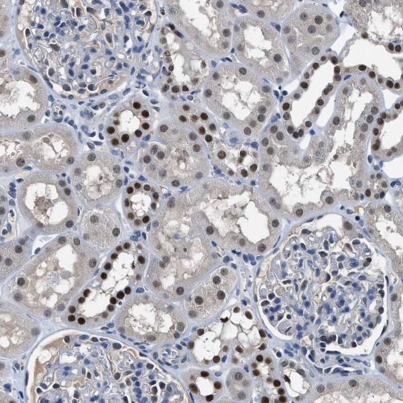 CART1 Antibody - BSA Free Immunohistochemistry-Paraffin: CART1 Antibody - BSA Free [NBP1-88190]