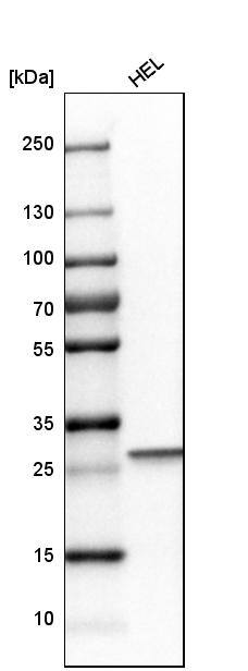 Carbonic Anhydrase I/CA1 Antibody - BSA Free Western Blot: Carbonic Anhydrase I/CA1 Antibody - BSA Free [NBP1-88191]