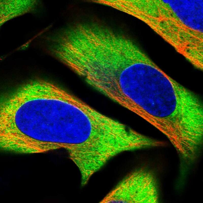 GPIP137 Antibody - BSA Free Immunocytochemistry/ Immunofluorescence: GPIP137 Antibody [NBP1-88195]