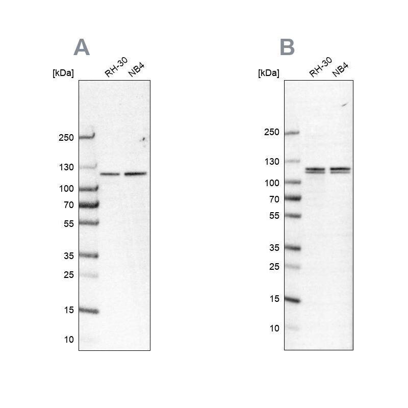 GPIP137 Antibody - BSA Free Western Blot: GPIP137 Antibody - BSA Free [NBP1-88195]