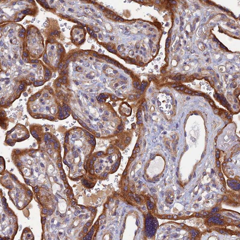 HCAP-G Antibody - BSA Free Immunohistochemistry-Paraffin: HCAP-G Antibody - BSA Free [NBP1-88199]