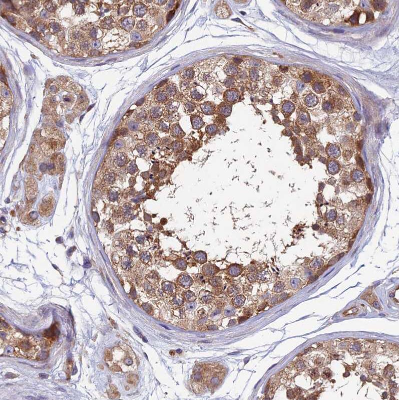 HCAP-G Antibody - BSA Free Immunohistochemistry-Paraffin: HCAP-G Antibody - BSA Free [NBP1-88199]