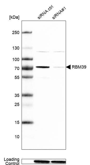 HCC1 Antibody - BSA Free Western Blot: HCC1 Antibody - BSA Free [NBP1-88200]