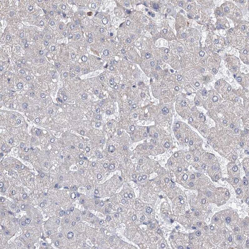 CNAP1 Antibody - BSA Free Immunohistochemistry-Paraffin: CNAP1 Antibody - BSA Free [NBP1-88202]