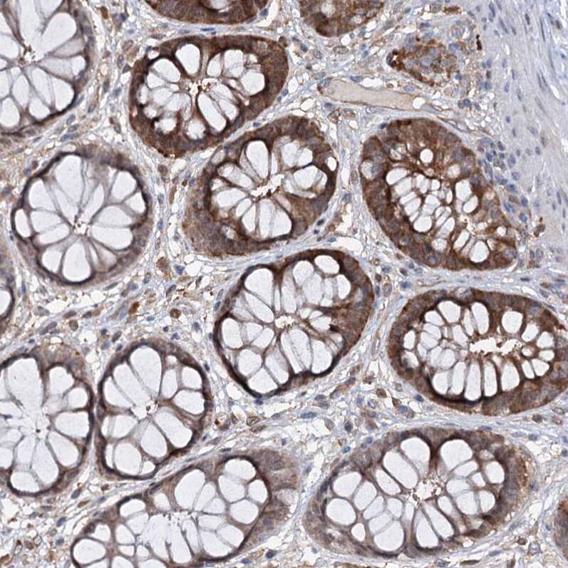 CNAP1 Antibody - BSA Free Immunohistochemistry-Paraffin: CNAP1 Antibody - BSA Free [NBP1-88202]