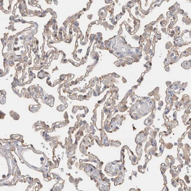 Calpain 2 Antibody - BSA Free Immunohistochemistry-Paraffin: Calpain 2 Antibody - BSA Free [NBP1-88204]