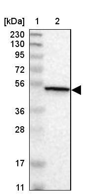 CaMKIV Antibody - BSA Free Western Blot: CaMKIV Antibody - BSA Free [NBP1-88209]