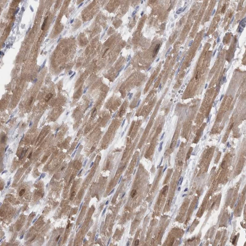 CaM Kinase II delta Antibody - BSA Free Immunohistochemistry-Paraffin: CaM Kinase II delta Antibody - BSA Free [NBP1-88211]