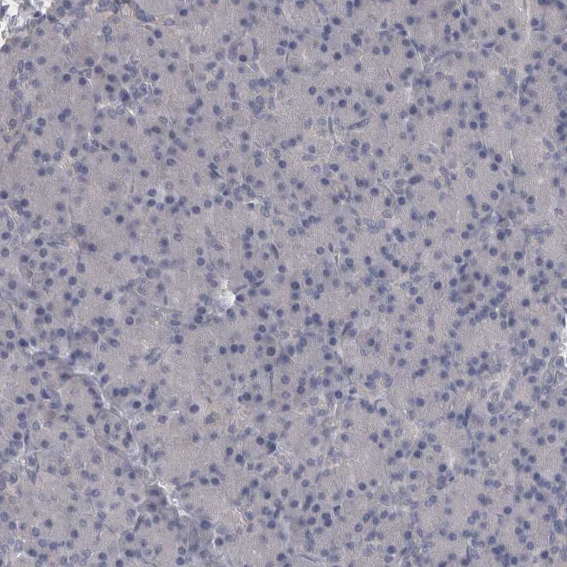 CaM Kinase II delta Antibody - BSA Free Immunohistochemistry-Paraffin: CaM Kinase II delta Antibody - BSA Free [NBP1-88211]