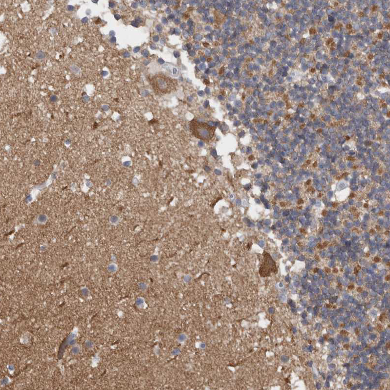 CaM Kinase II delta Antibody - BSA Free Immunohistochemistry-Paraffin: CaM Kinase II delta Antibody - BSA Free [NBP1-88211]