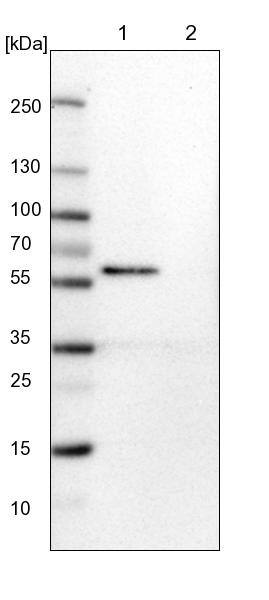 CaMKII beta Antibody - BSA Free Western Blot: CaMKII beta Antibody - BSA Free [NBP1-88212]