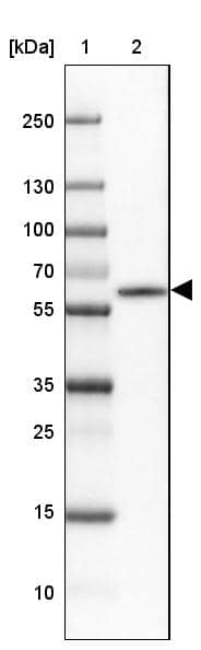 CaMKII beta Antibody - BSA Free Western Blot: CaMKII beta Antibody - BSA Free [NBP1-88212]