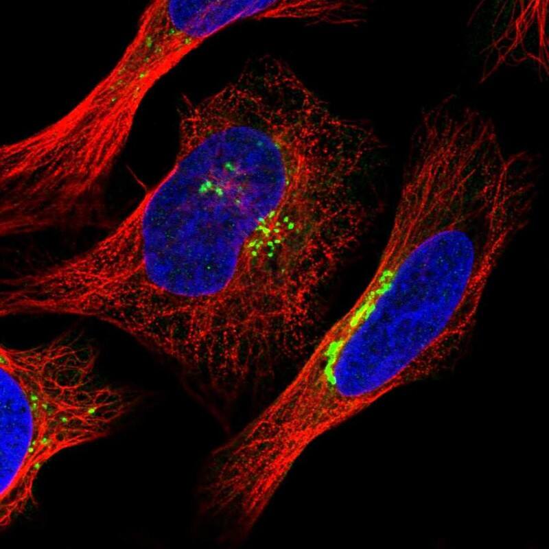 PIST Antibody - BSA Free Immunocytochemistry/ Immunofluorescence: PIST Antibody [NBP1-88223]