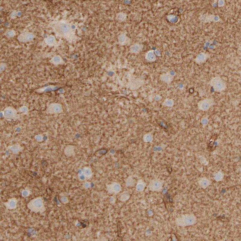PIST Antibody - BSA Free Immunohistochemistry-Paraffin: PIST Antibody - BSA Free [NBP1-88223]