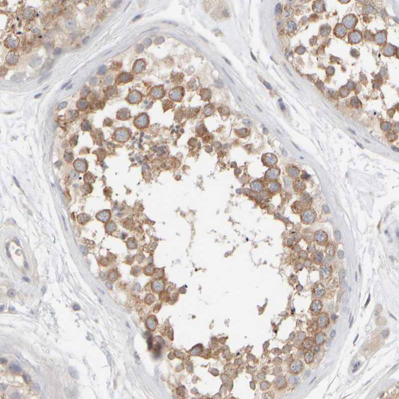 PIST Antibody - BSA Free Immunohistochemistry-Paraffin: PIST Antibody - BSA Free [NBP1-88223]