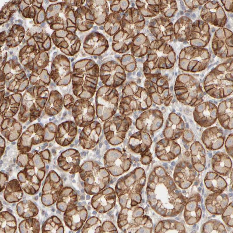 PIST Antibody - BSA Free Immunohistochemistry-Paraffin: PIST Antibody - BSA Free [NBP1-88223]