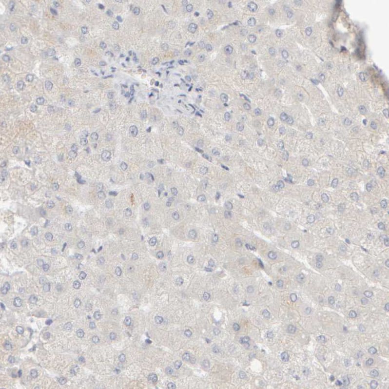 PIST Antibody - BSA Free Immunohistochemistry-Paraffin: PIST Antibody - BSA Free [NBP1-88223]