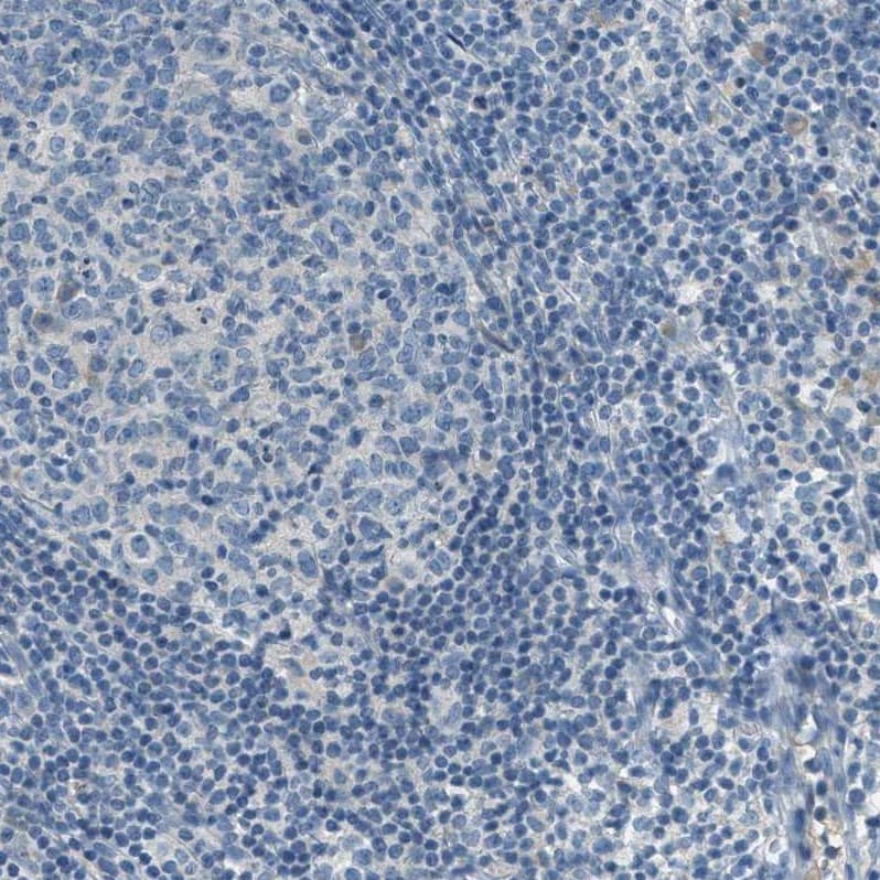 Mesothelin Antibody - BSA Free Immunohistochemistry-Paraffin: Mesothelin Antibody - BSA Free [NBP1-88224]