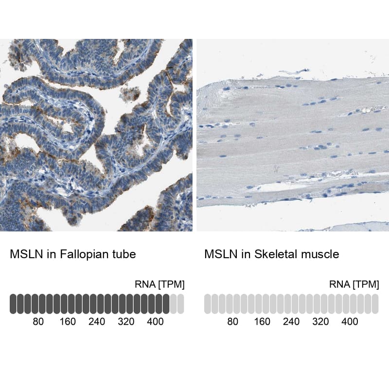 Mesothelin Antibody - BSA Free Immunohistochemistry-Paraffin: Mesothelin Antibody - BSA Free [NBP1-88224]