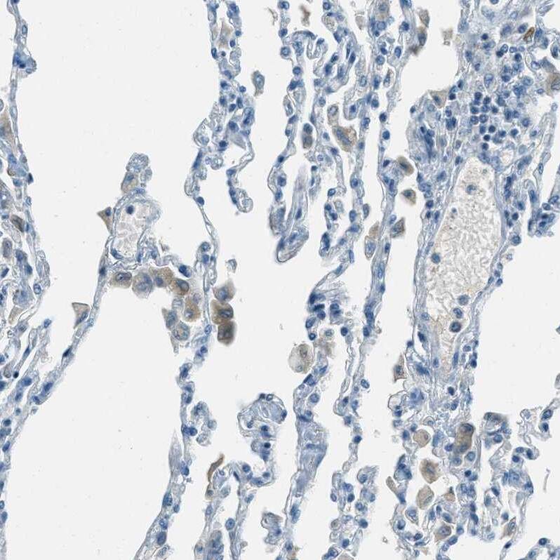 Mesothelin Antibody - BSA Free Immunohistochemistry-Paraffin: Mesothelin Antibody - BSA Free [NBP1-88224]