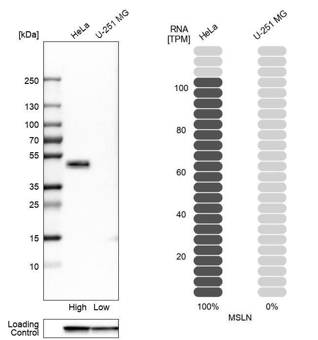 Mesothelin Antibody - BSA Free Western Blot: Mesothelin Antibody - BSA Free [NBP1-88224]