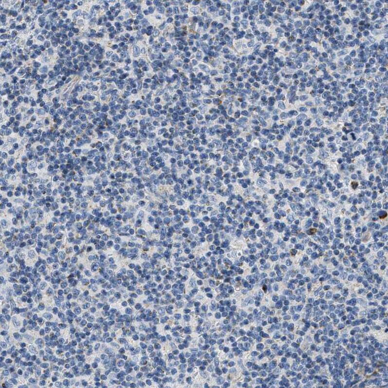 Carbonic Anhydrase IV/CA4 Antibody - BSA Free Immunohistochemistry-Paraffin: Carbonic Anhydrase IV/CA4 Antibody - BSA Free [NBP1-88225]