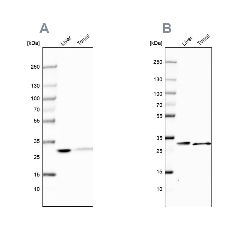 Carbonic Anhydrase III/CA3 Antibody - BSA Free Western Blot: Carbonic Anhydrase III/CA3 Antibody - BSA Free [NBP1-88228]