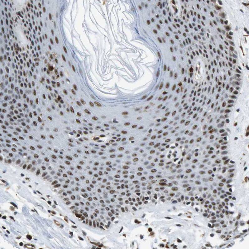 p400 Antibody - BSA Free Immunohistochemistry-Paraffin: p400 Antibody - BSA Free [NBP1-88230]