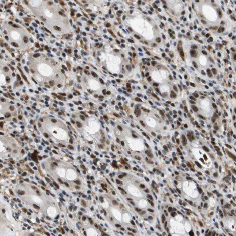 p400 Antibody - BSA Free Immunohistochemistry-Paraffin: p400 Antibody - BSA Free [NBP1-88230]