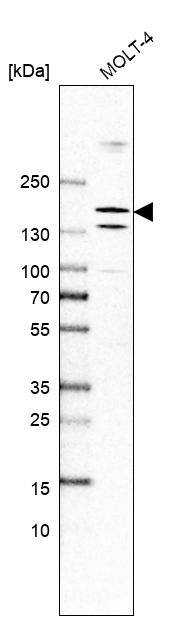 PTIP Antibody - BSA Free Western Blot: PTIP Antibody - BSA Free [NBP1-88233]